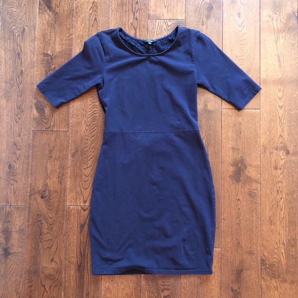 Aritzia Talula lace open back dress - Picture 2 of 4